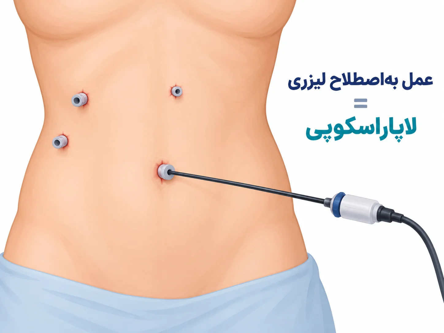 آناتومی کیسه صفرا و مسیر حرکت سنگ به مجرای صفراوی